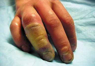 Image d'illustration pour Neige et froid : vos questions et nos réponses